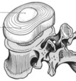 2-disco-intervertebrale